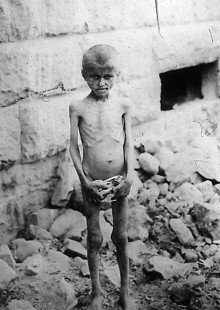Ein hungerndes Kind in Jerewan, 1916